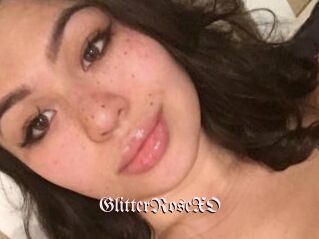 GlitterRoseXO